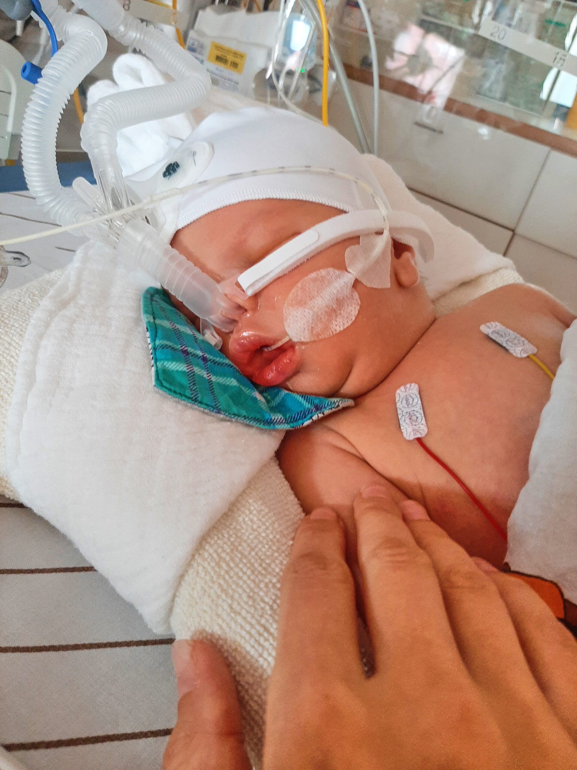 Mein durch die Geburt geschädigtes Kind im Inkubator, beatmet und an Schläuche angeschlossen.